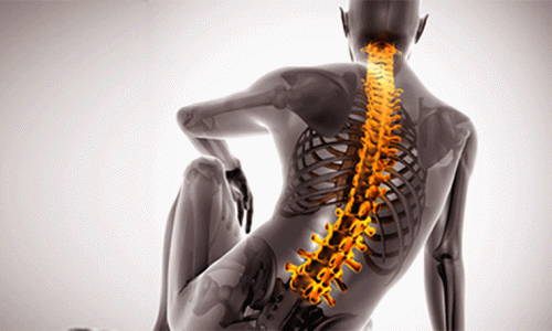 Изкривяване на гръбнака – видове, диагностика и как се лекува?
