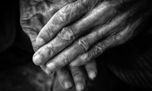 Артрит на пръстите на ръцете – ефективно народно лечение