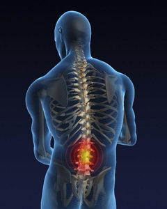 Поясен отдел на гръбначен стълб - поема тежестта на горната част на тялото и е подложен на големи натоварвания