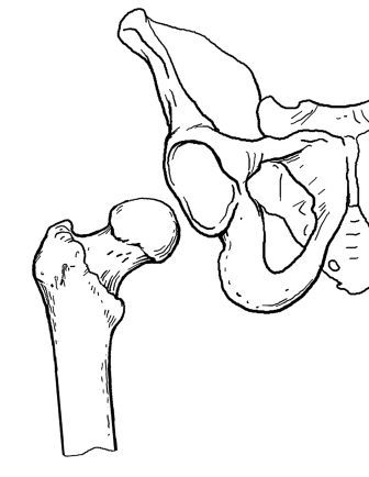 Анатомия на тазобедрената става - съединение на бедрената кост и тазовата кост