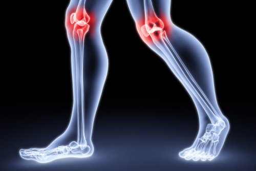 Най-предразположени към заболяване са коленните стави.