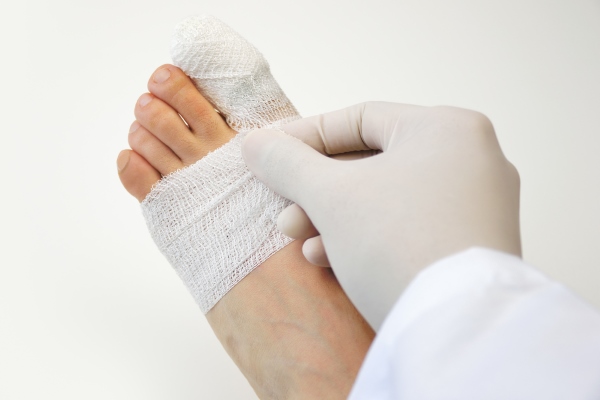 Леден компрес на крака, разтривки и болкоуспокояващи при нараняване на пръста.
